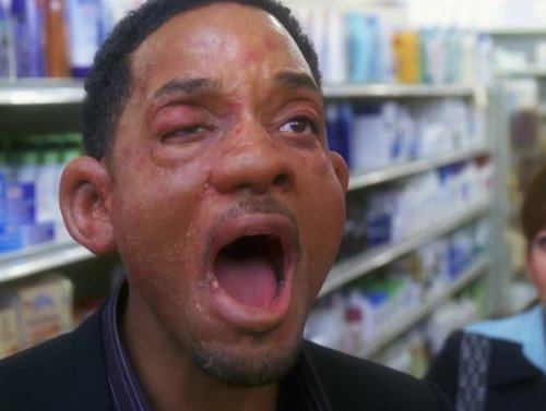 No, it’s not filler. It’s an allergic reaction. (25 Photos) 1