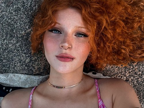 Freckles? You mean sexy face seasoning? (35 Photos) 1